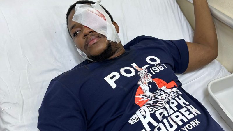 Kinshasa : un jeune journaliste perd un œil après une violente agression, son père lance un appel à la justice